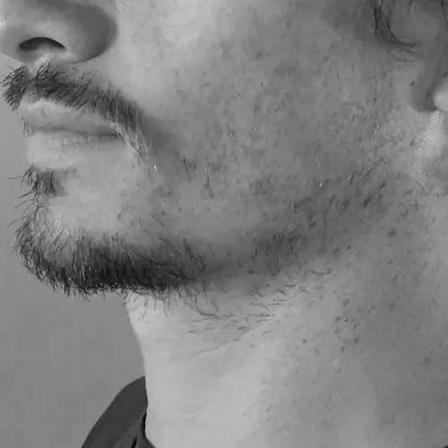 The Benefits of Beard Micropigmentation